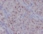 Anti-CDK2 Rabbit Monoclonal Antibody
